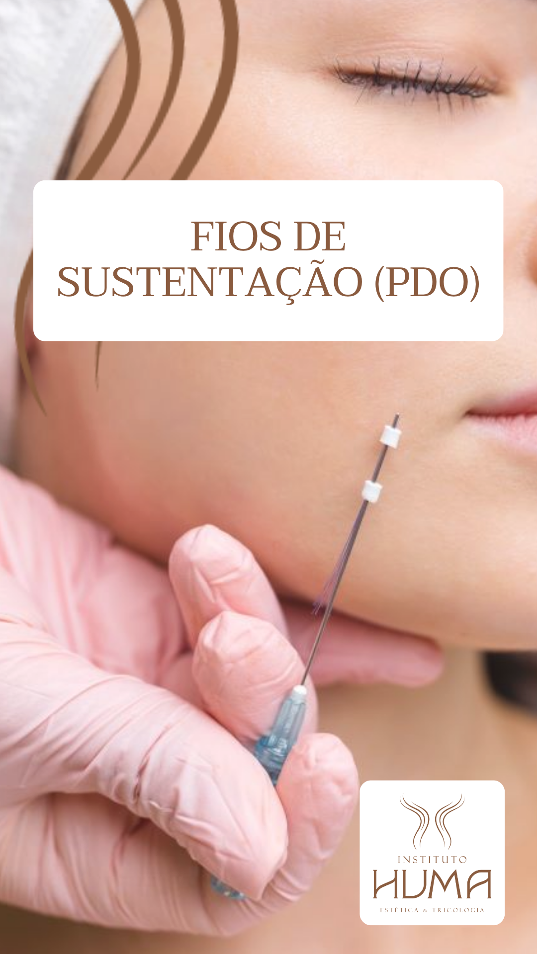 Clínica Estética - Fios de PDO em Santos